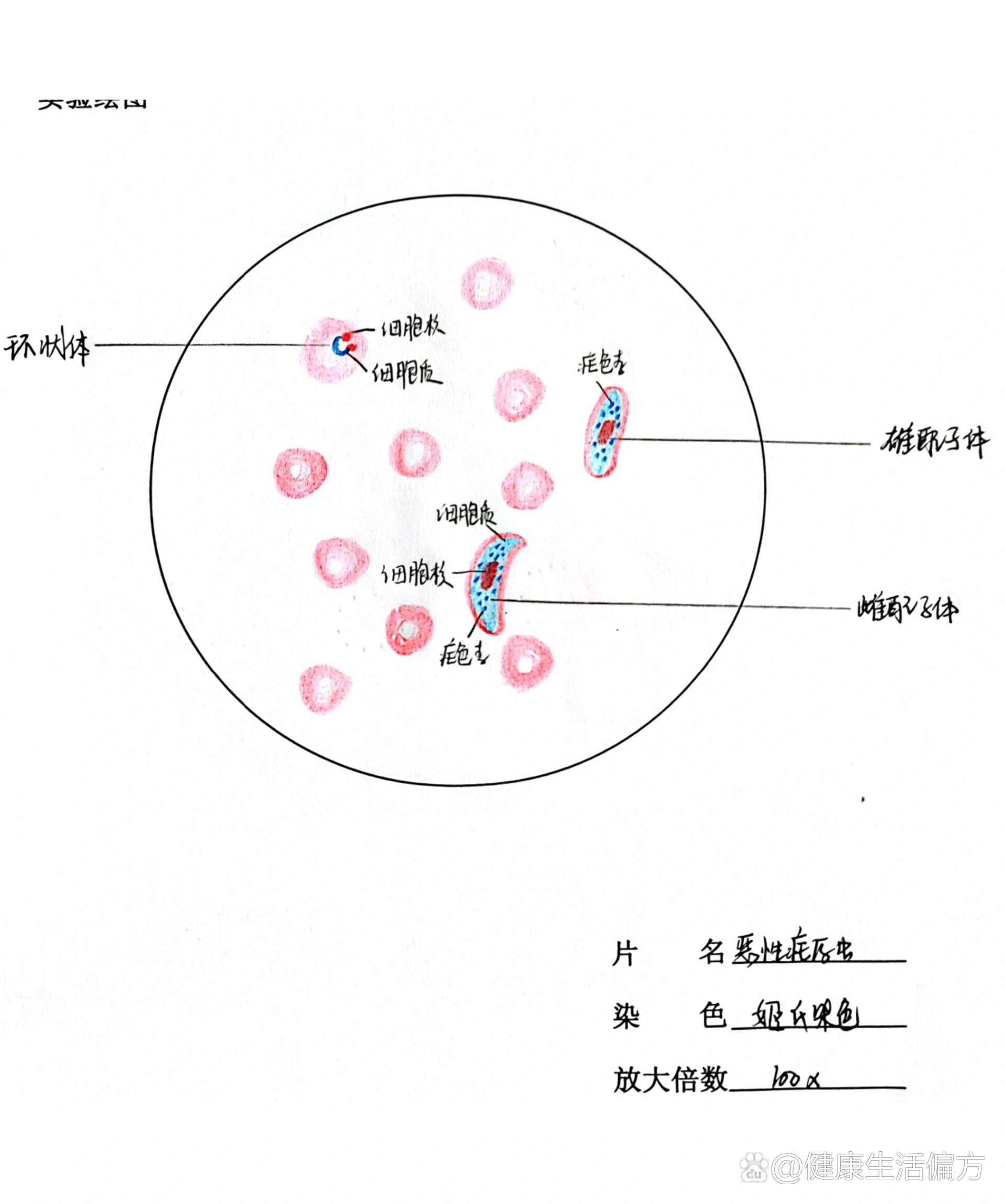 疟原虫小滋养体手绘图图片