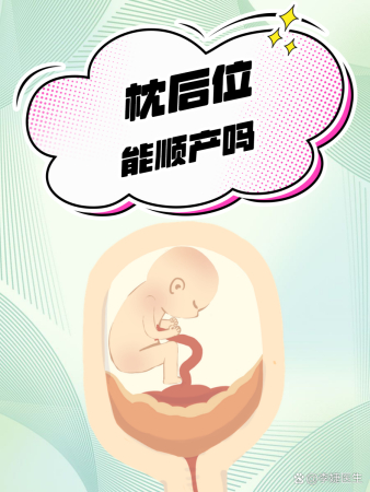 枕后位能顺产吗?