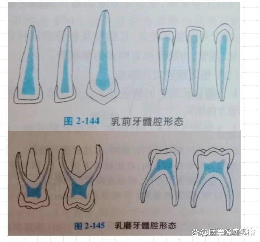 乳牙髓腔形态