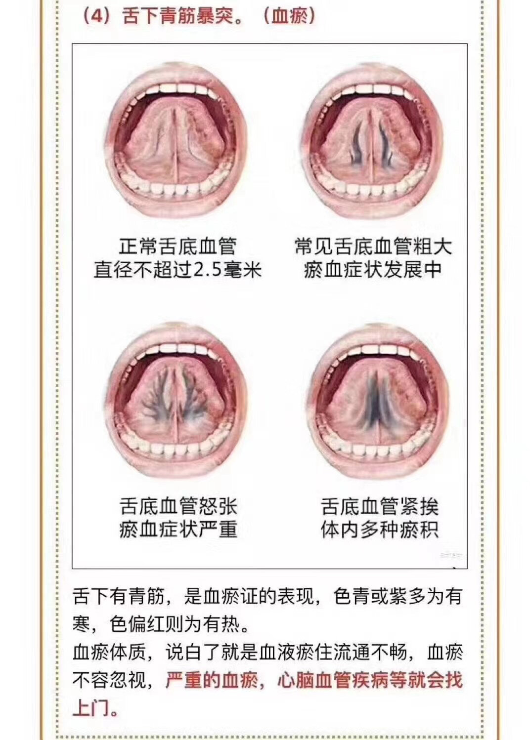 舌头构造图底部图片