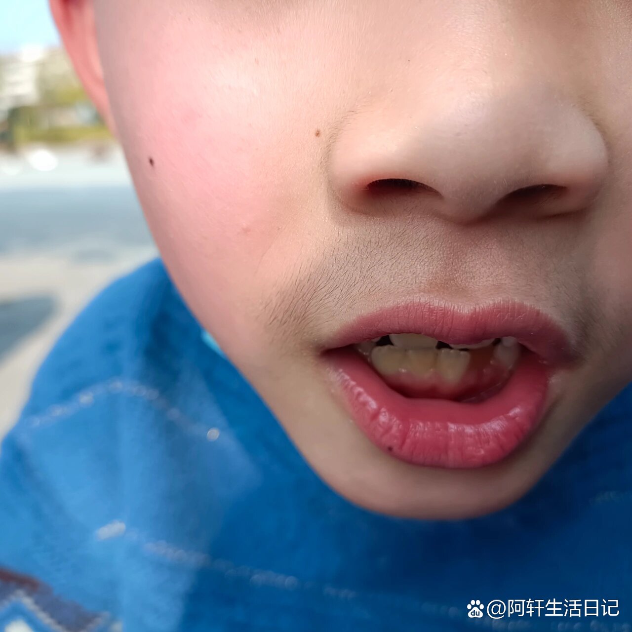 7岁,就长这么明显的胡子了,怎么办哦?