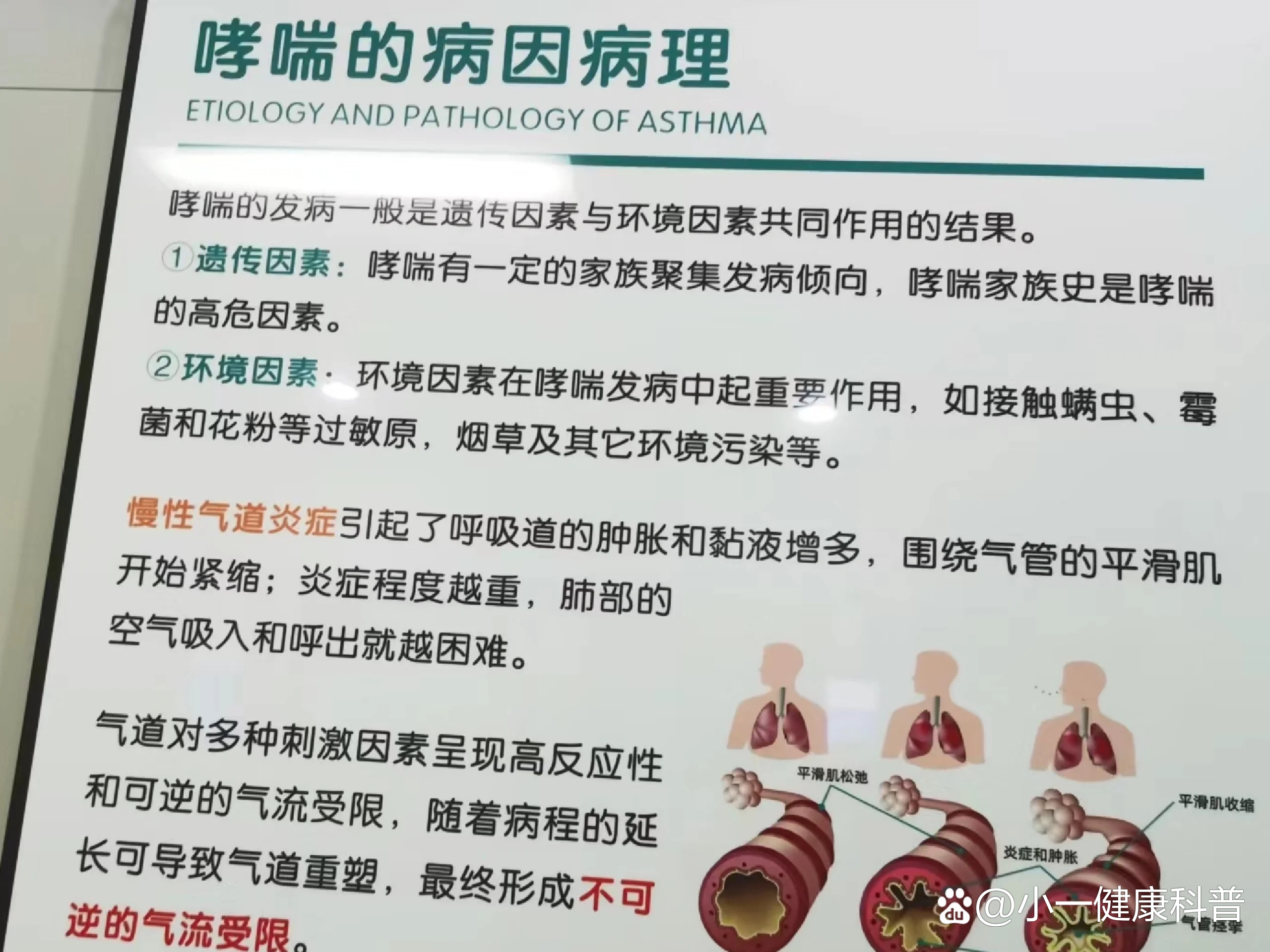 咳嗽变异性哮喘不发病时能查出来吗?