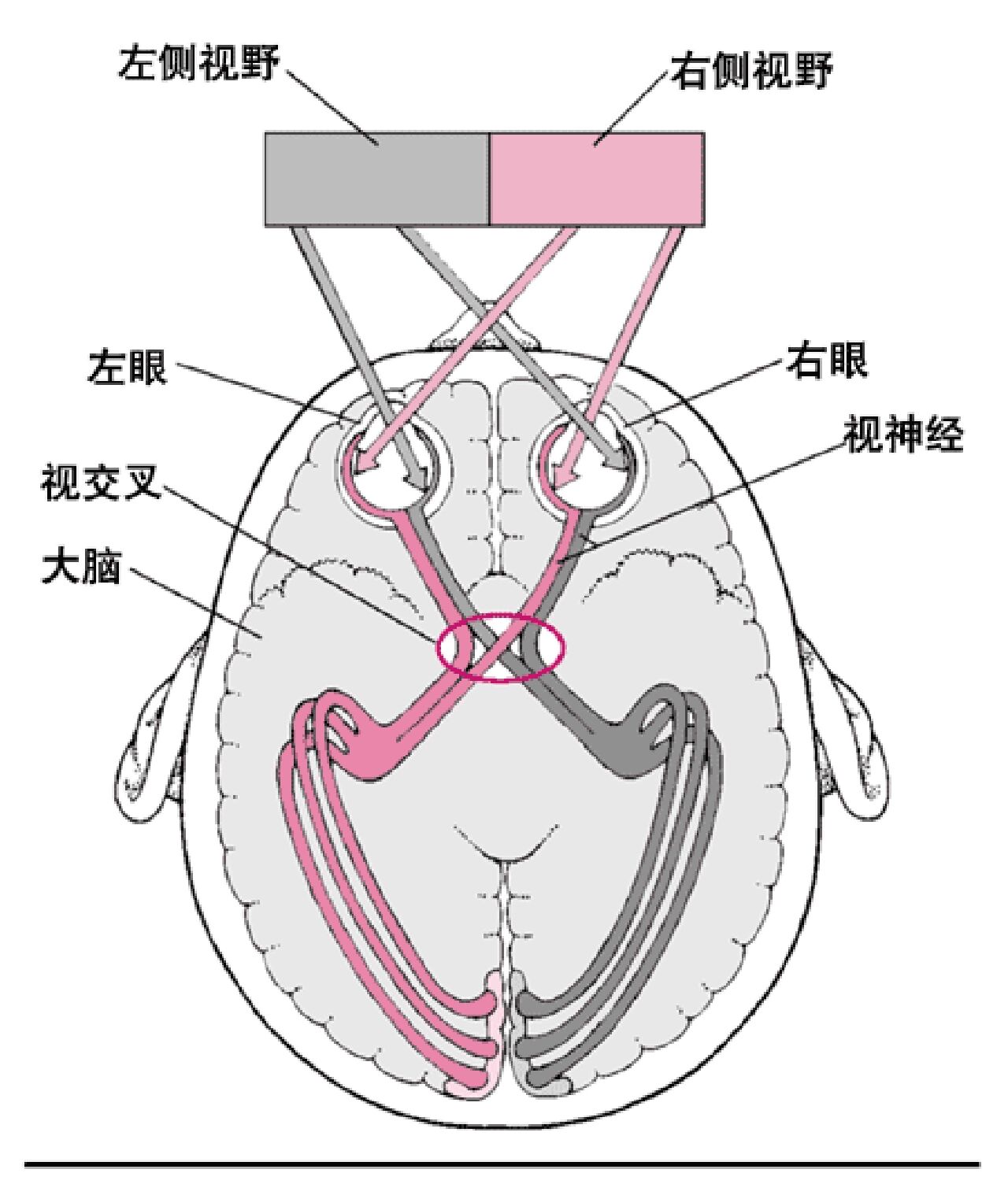 右侧偏盲图片