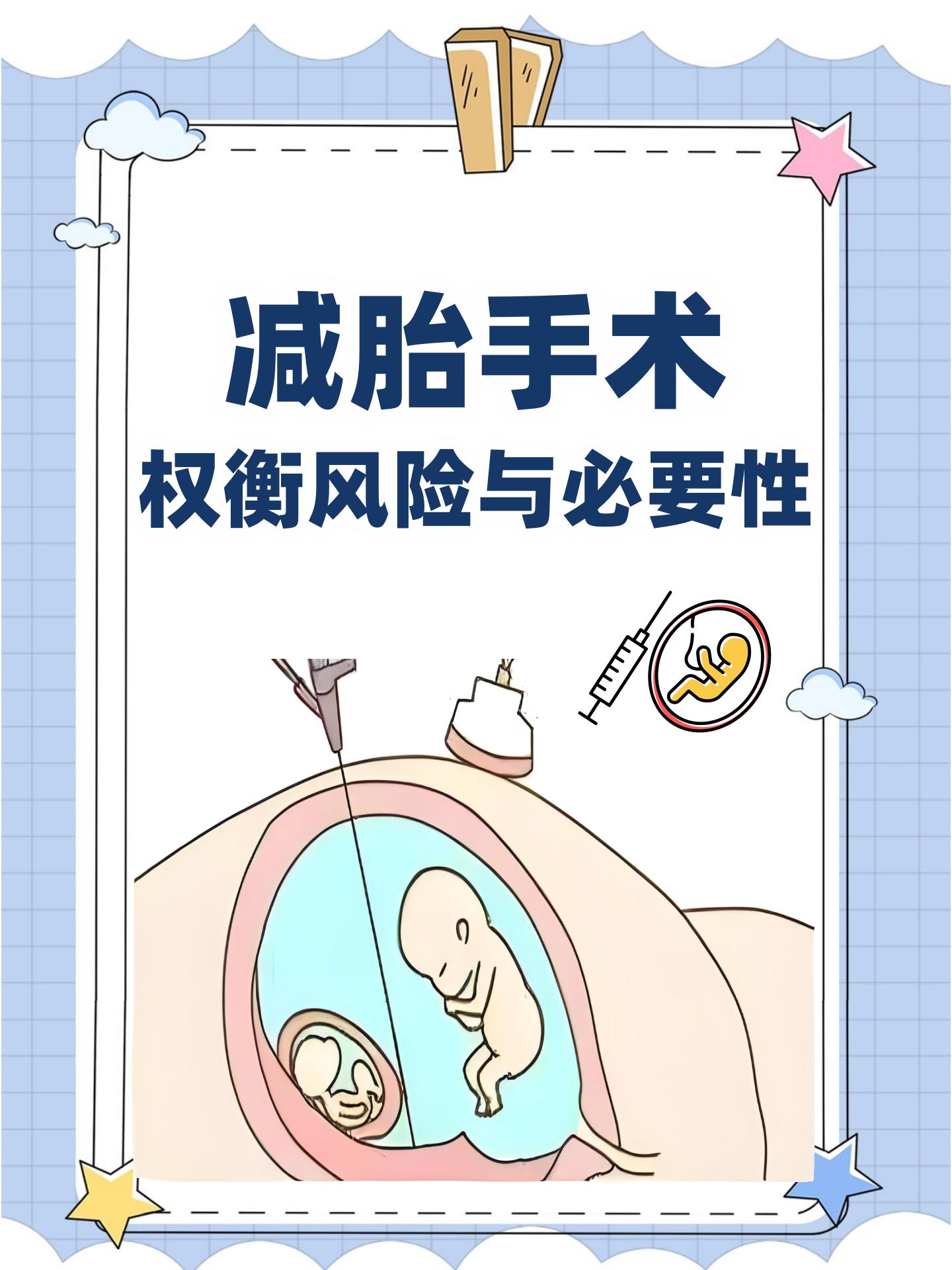 减胎手术:权衡风险与必要性