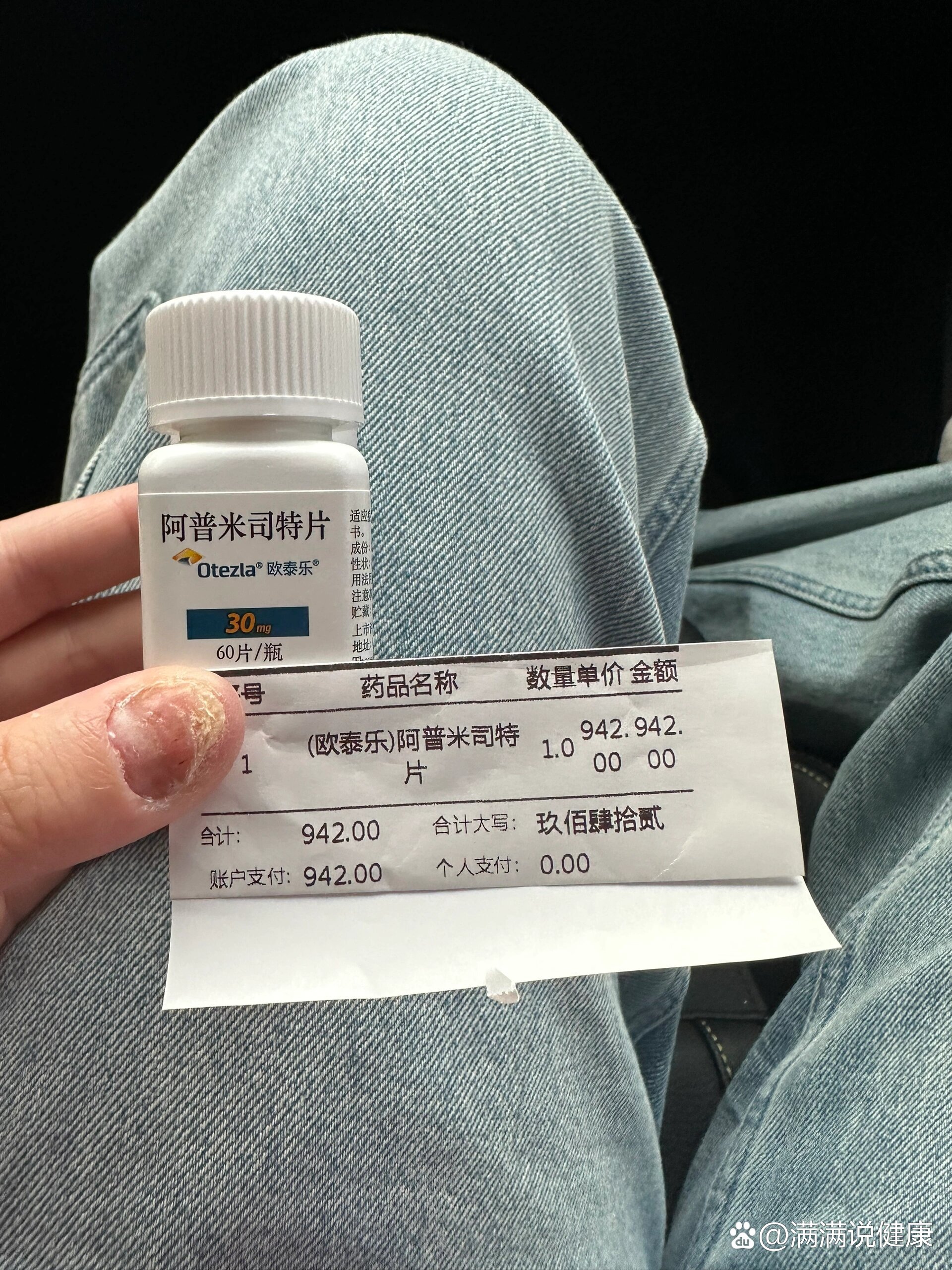 阿普米司特