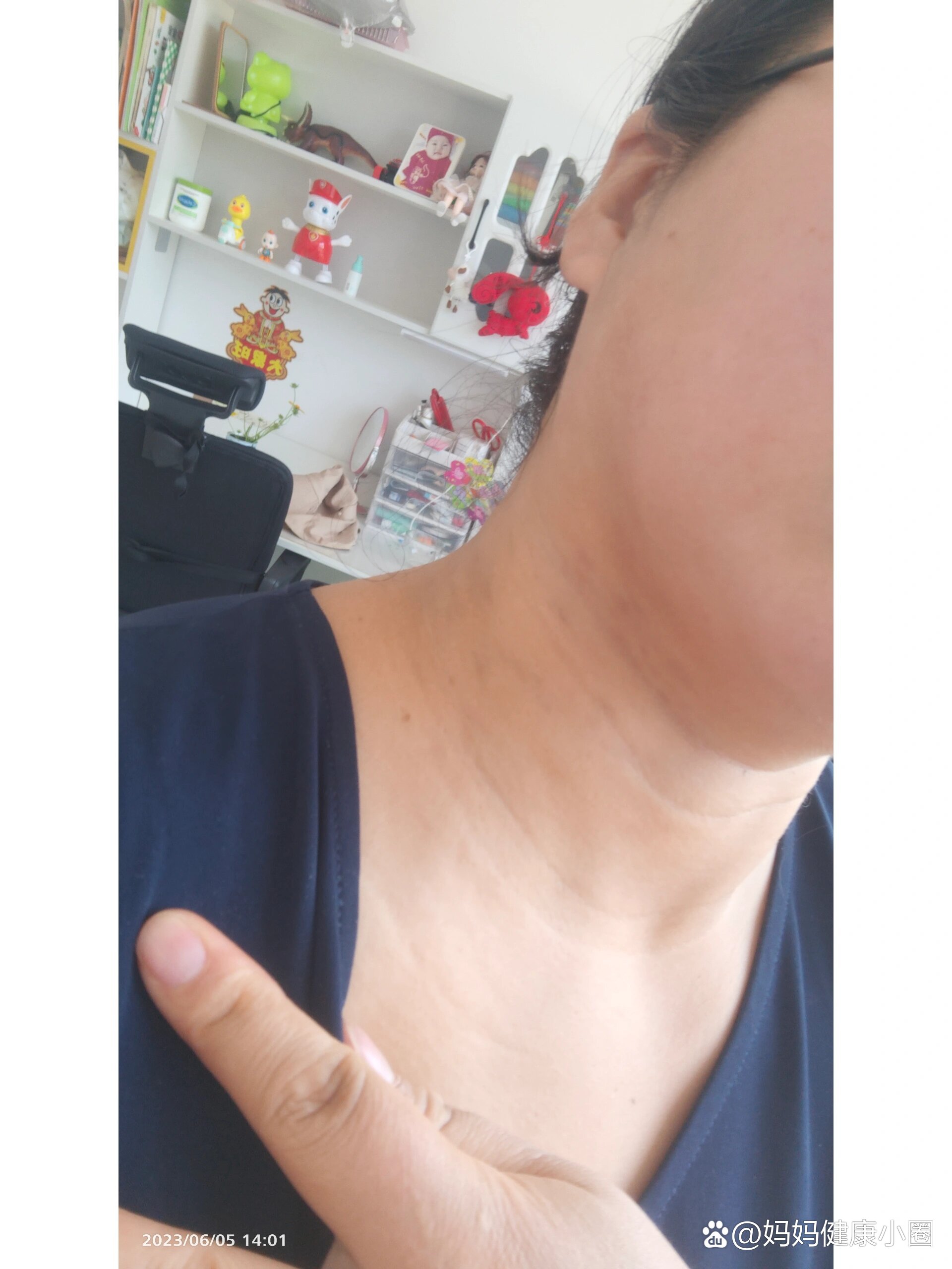 脖子黑色素沉积严重