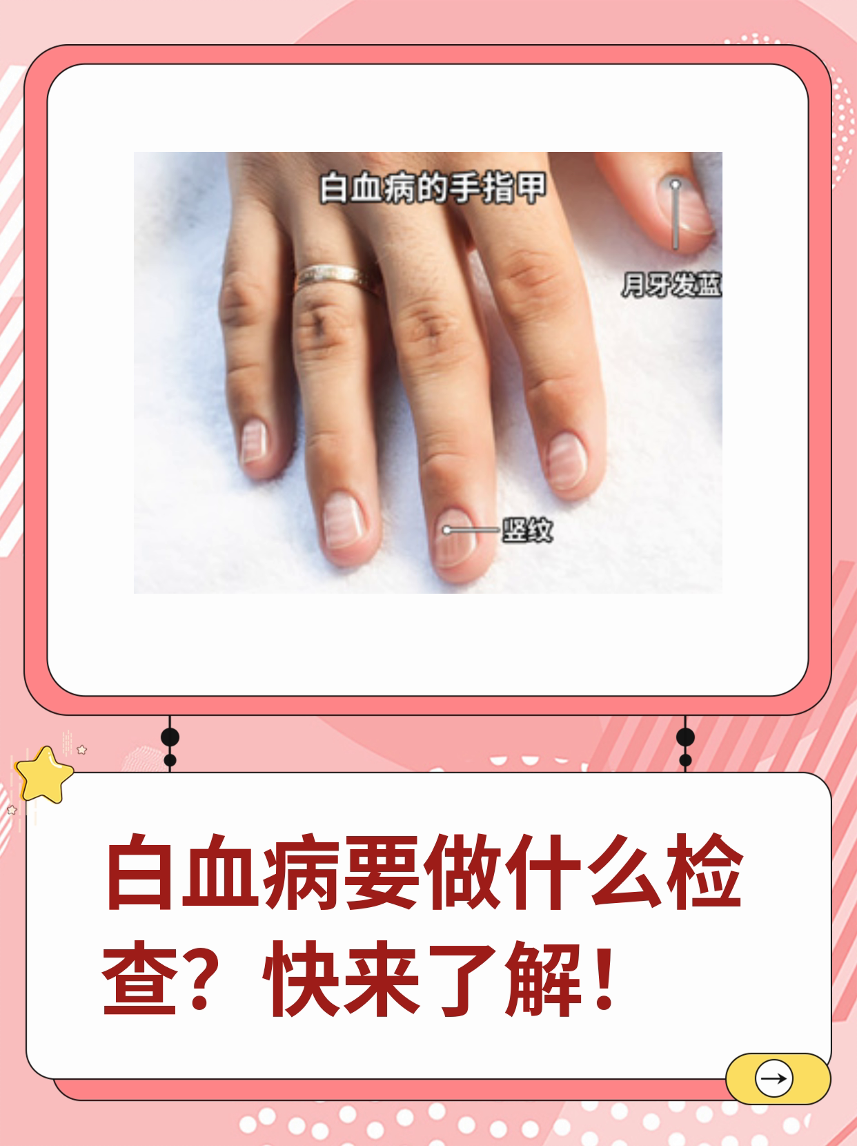 白血病要做什么检查?快来了解一下