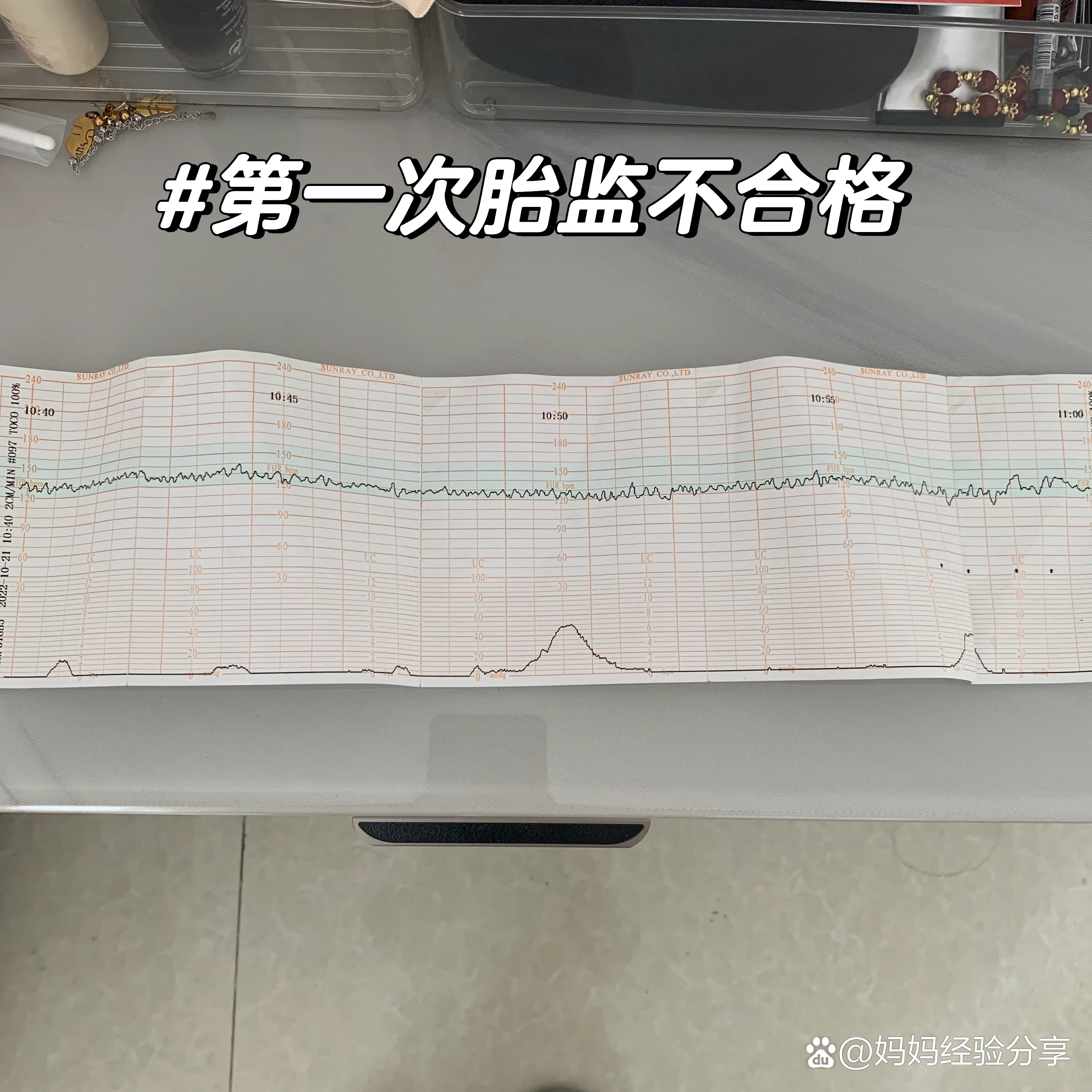 32周|第一次胎心监护以失败告终
