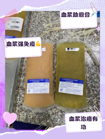 打血浆的作用和功效