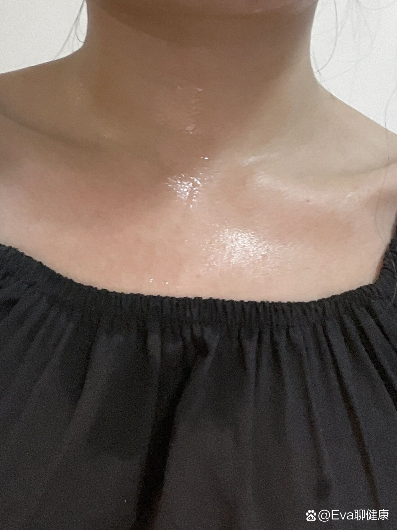 为什么一喝水就出汗什么原因为什么在线