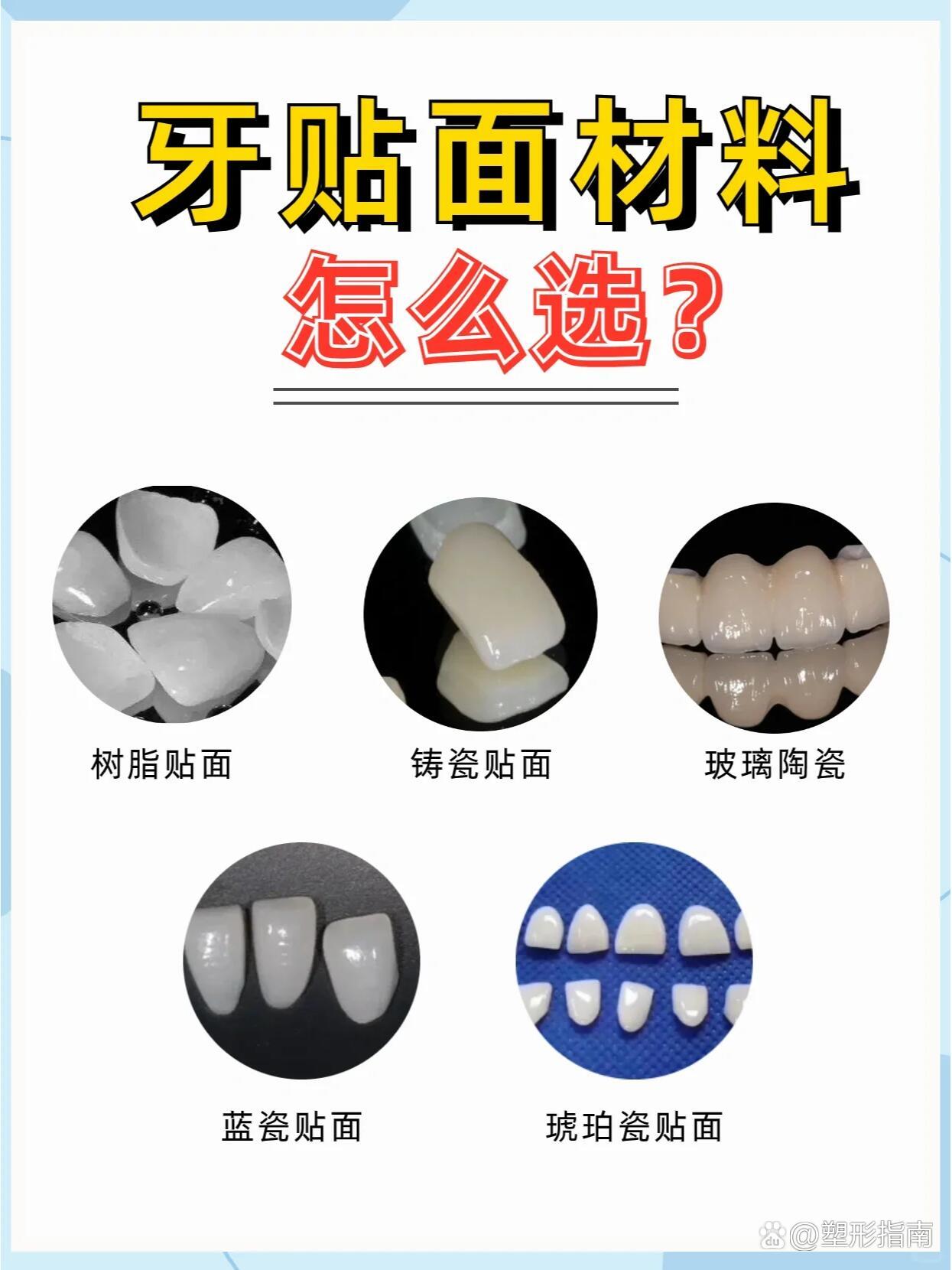 牙齿贴面揭秘:市面上牙齿贴面的种类及优点
