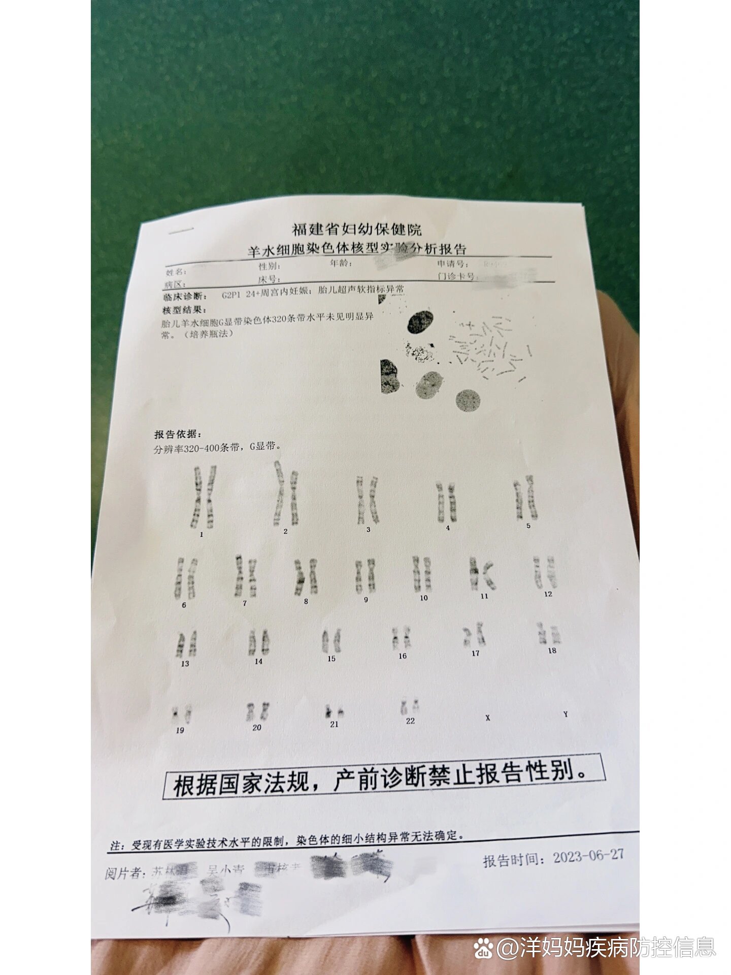 羊穿报告异常,15号染色体存在微缺失.