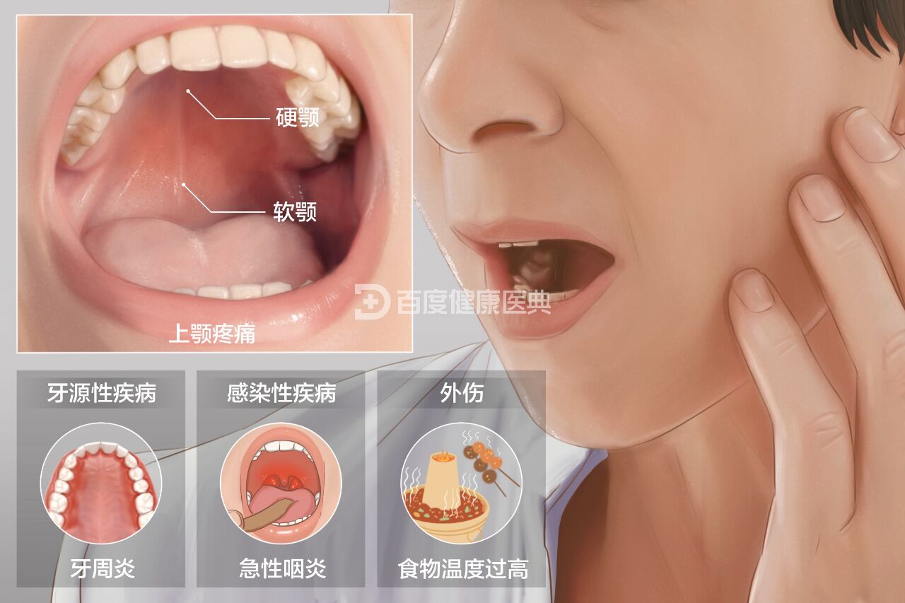 04上颚疼痛该怎么办71