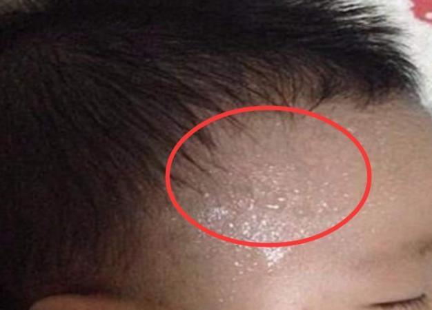 为啥动不动就“满头大汗”，真的是身体虚吗？