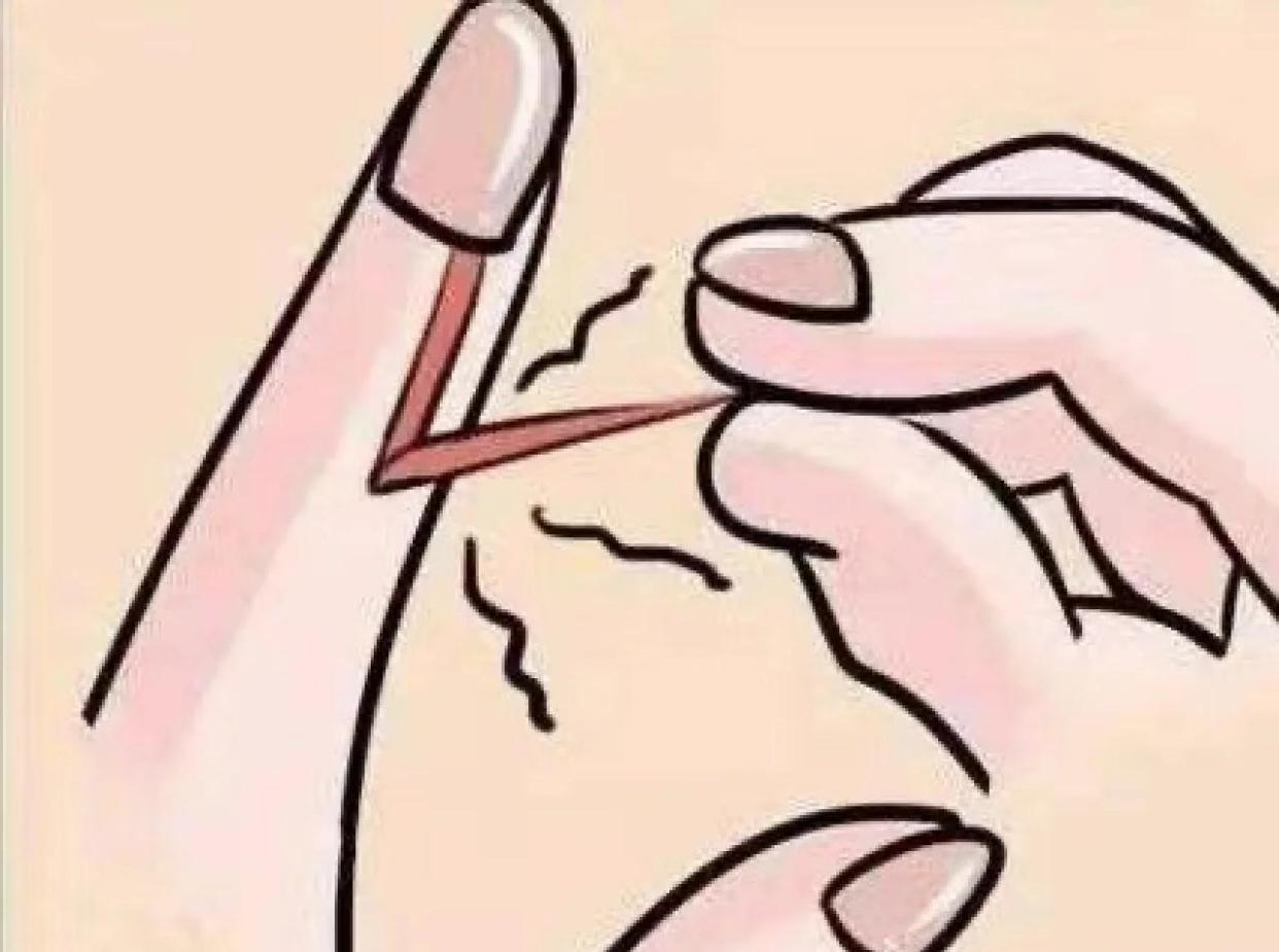 🌸春天手上倒刺多？