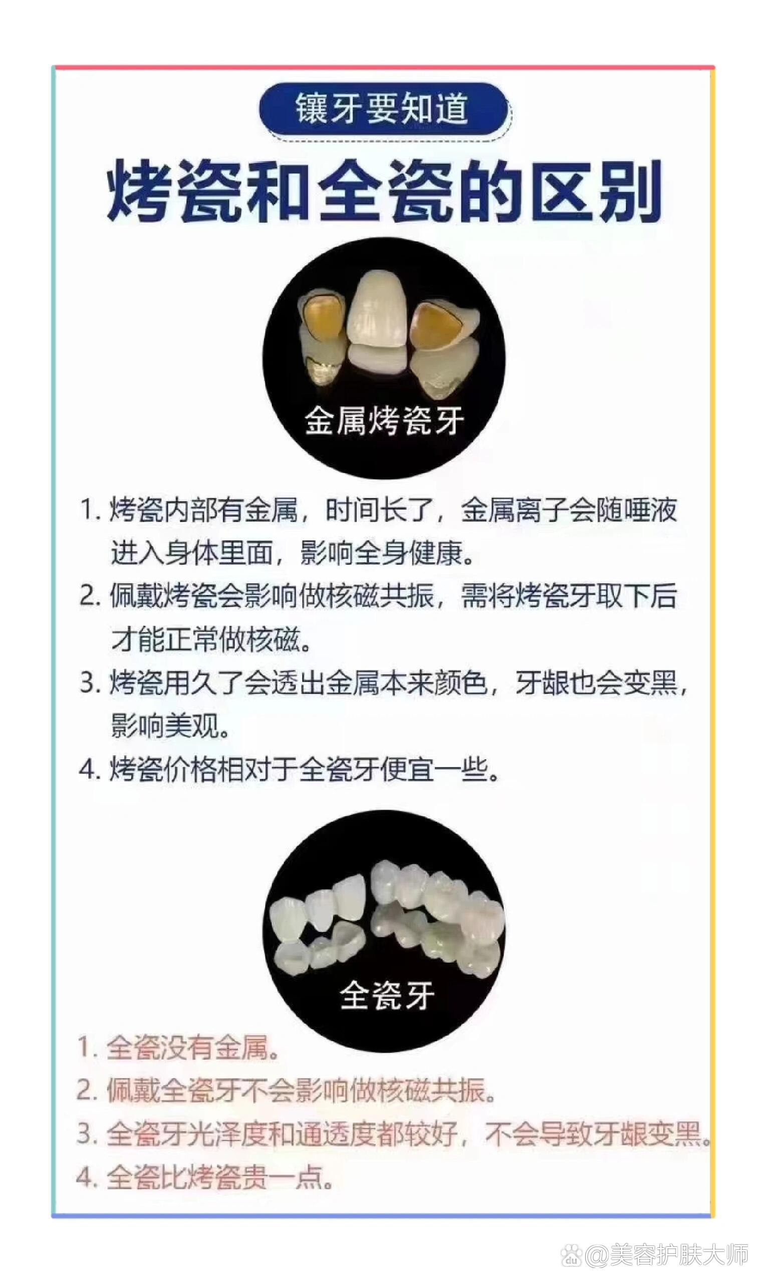 瓷冠与全瓷冠的区别
