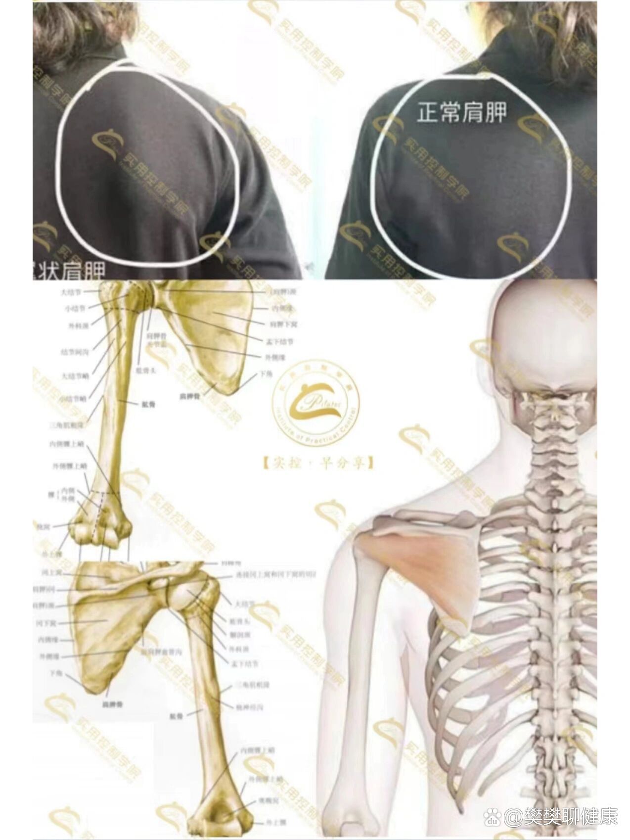 肩胛骨分区图片