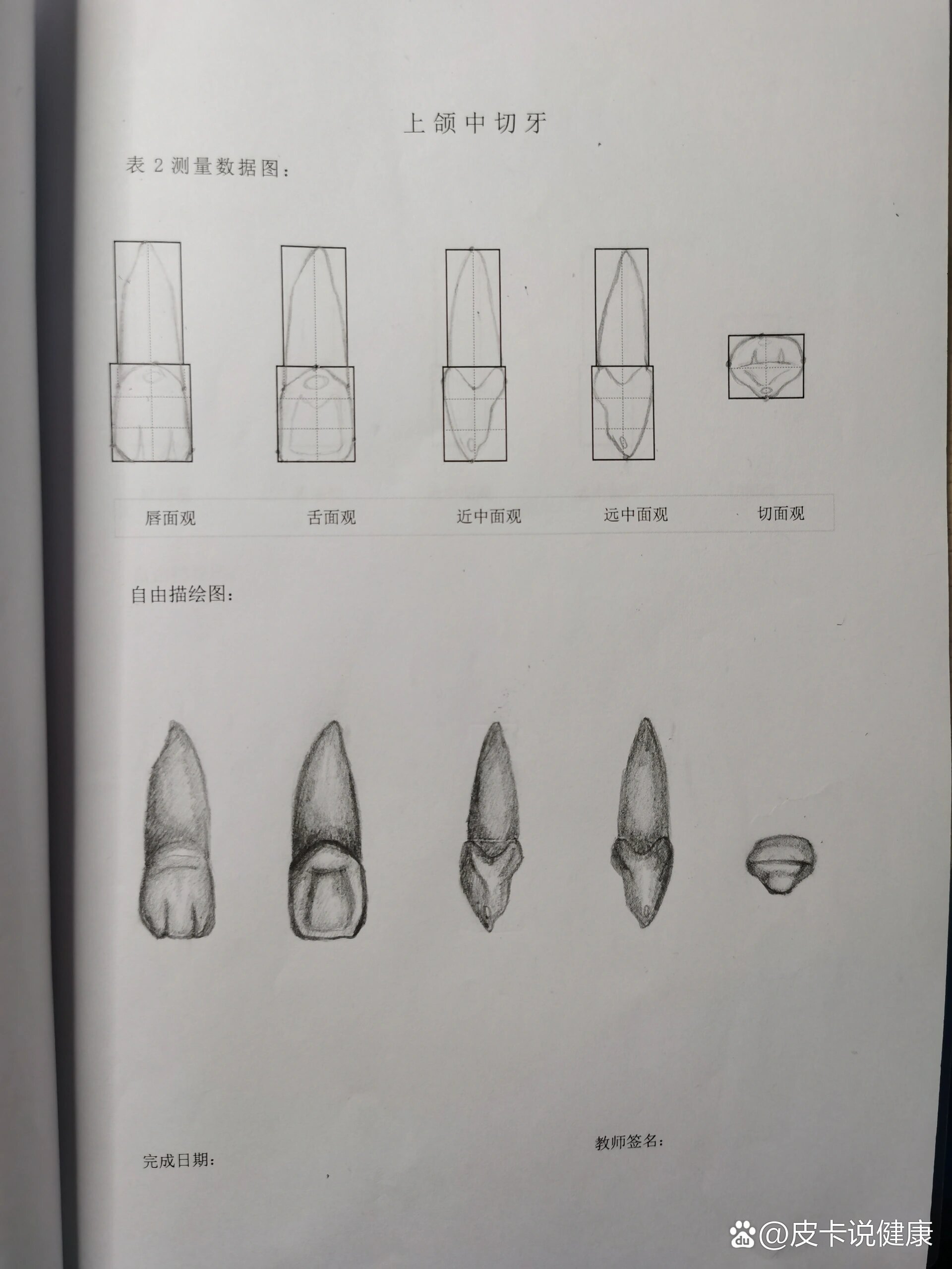 中切牙位置图片