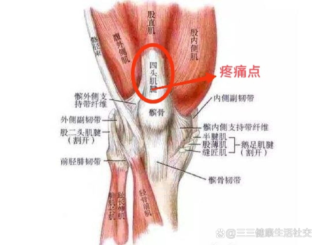 膝盖内侧走路疼图片