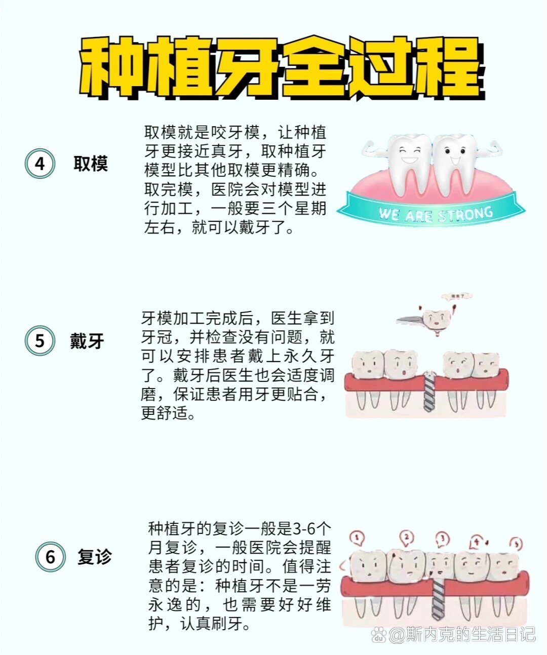 史上最详细的种植牙流程