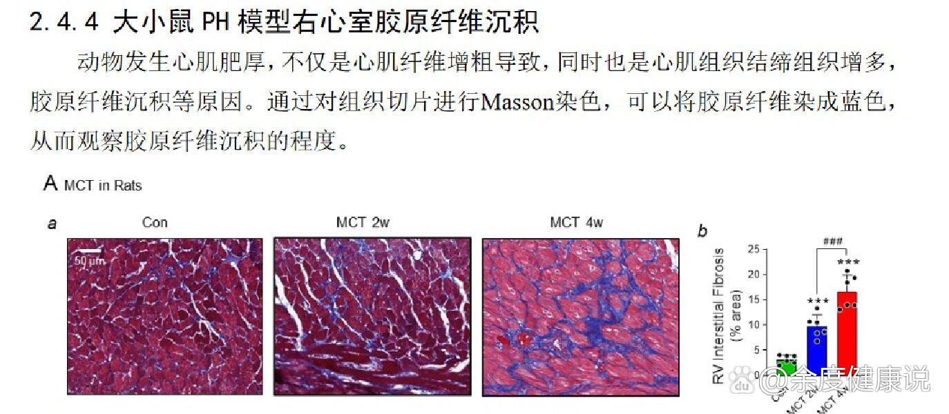 请教心脏切片角度