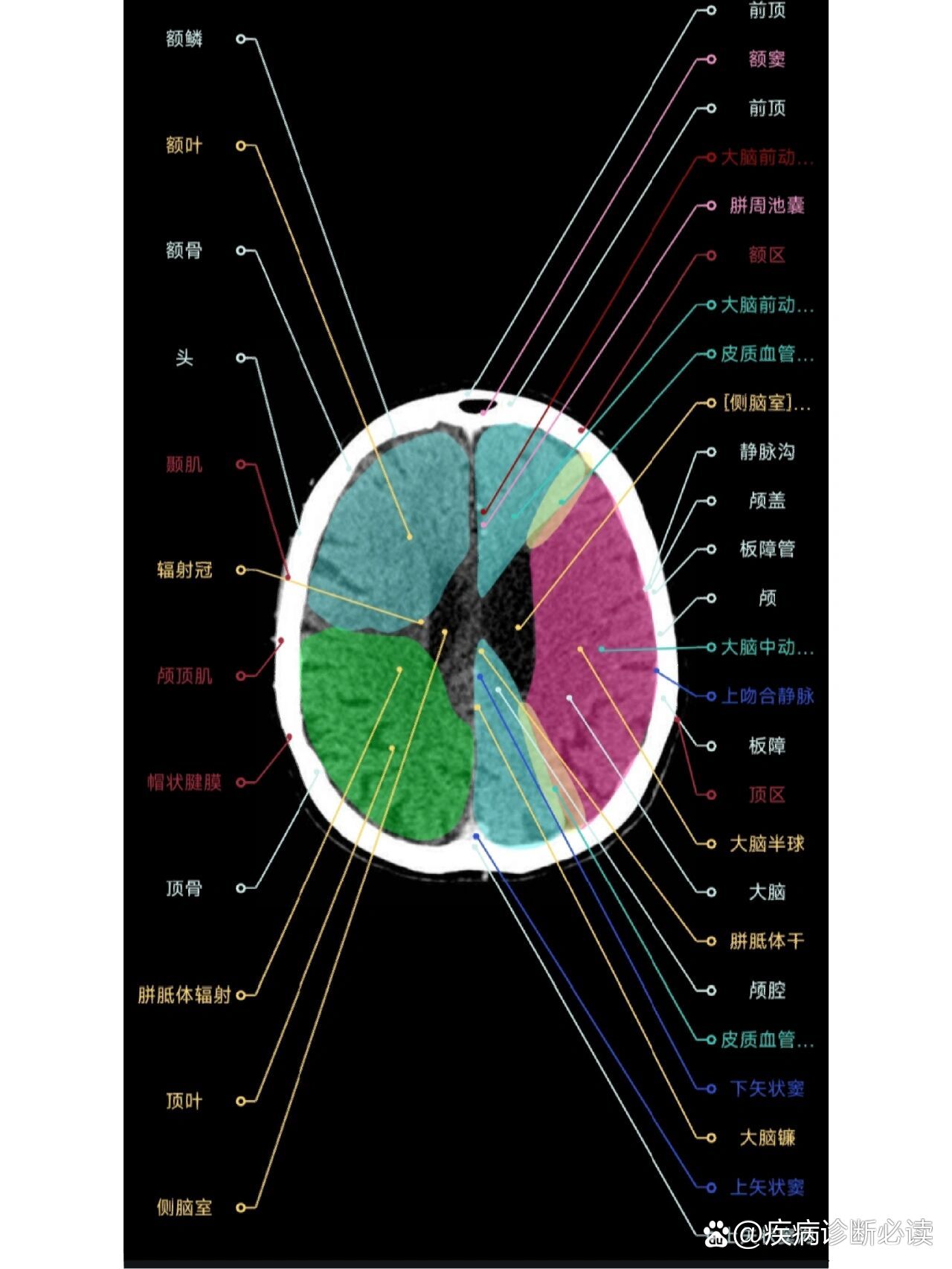 额叶的解剖结构图图片