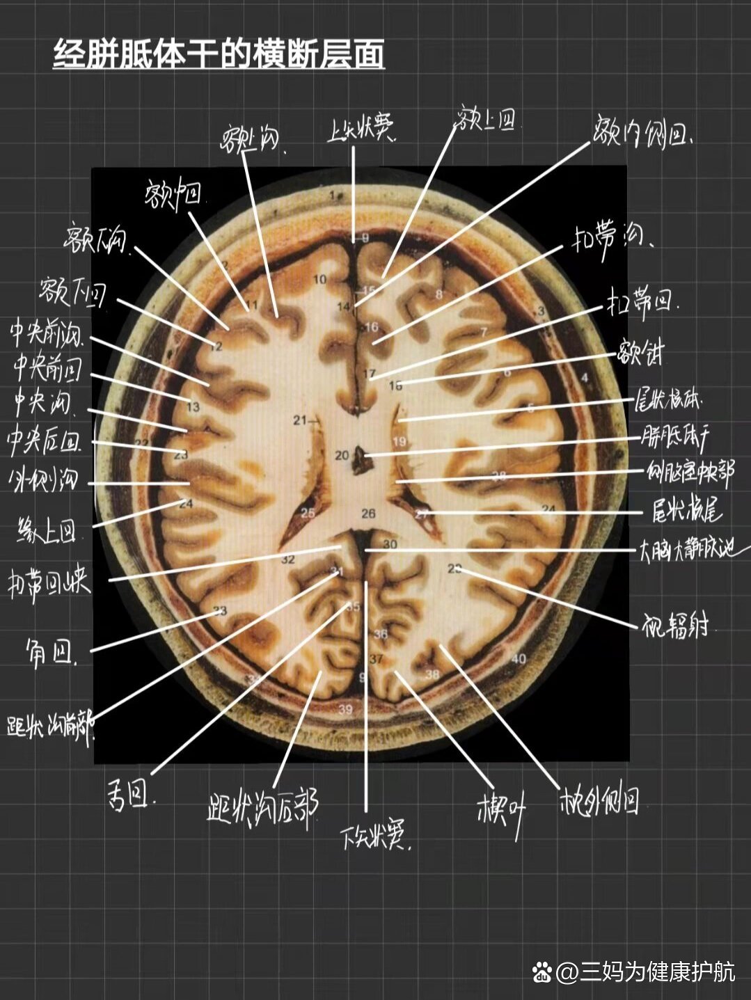 脑干横断面解剖图片