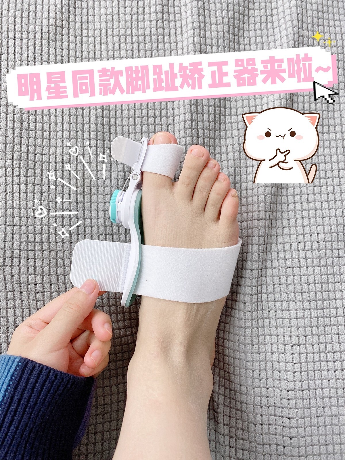 明星同款脚趾矫正器来啦