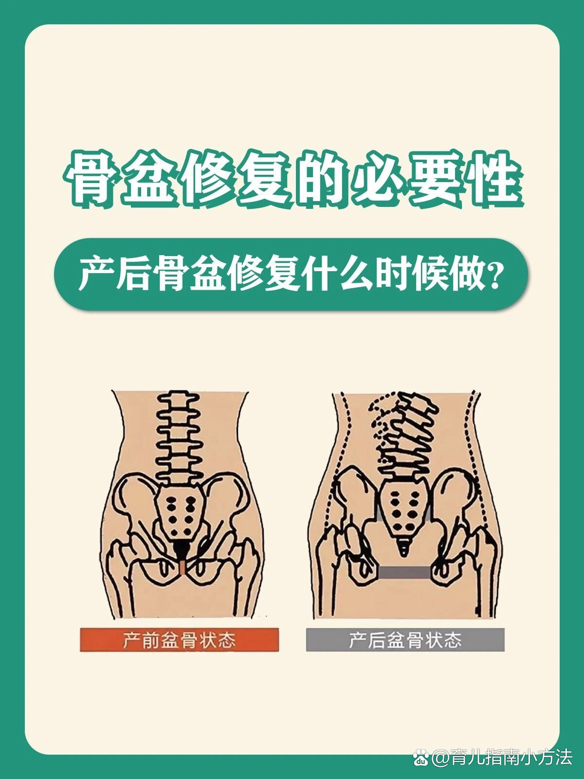 美容店里骨盆修复有用吗?(在美容店做骨盆修复有效果吗?)