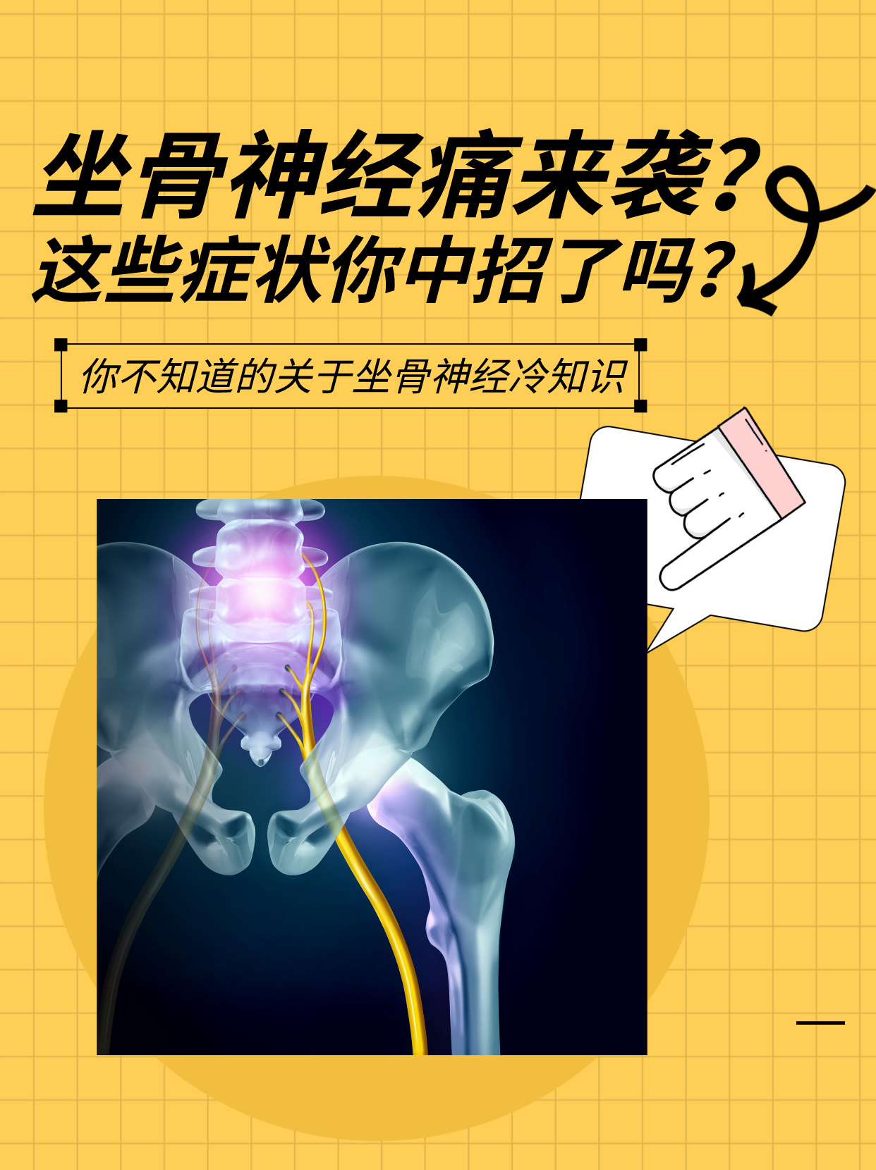 坐骨神经痛来袭?这些症状你中招了吗?