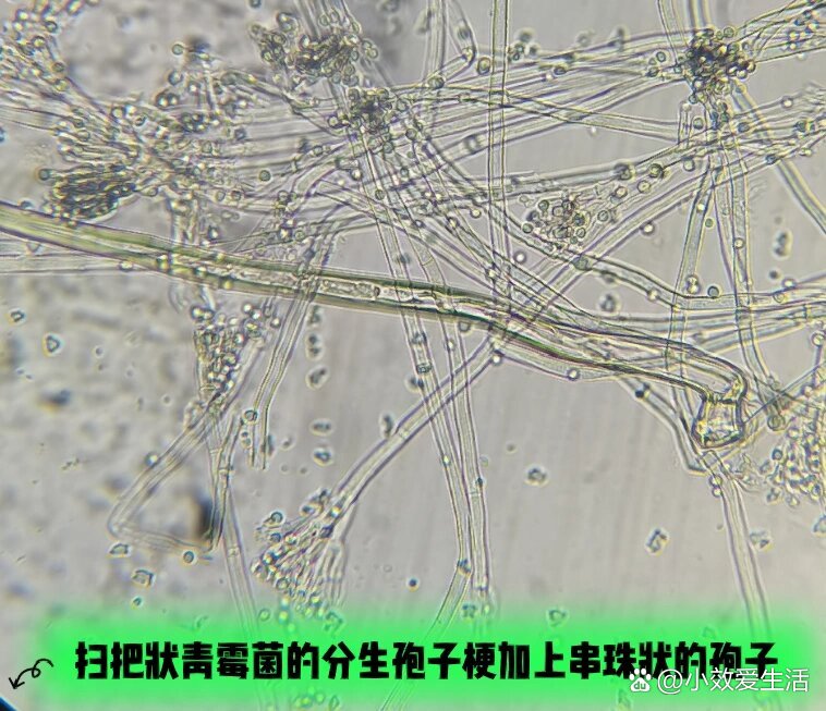 青霉形态结构图片