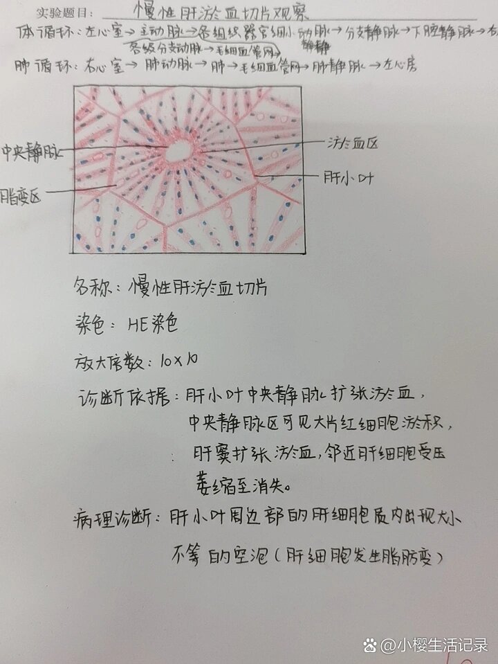 肝淤血大体手绘图图片