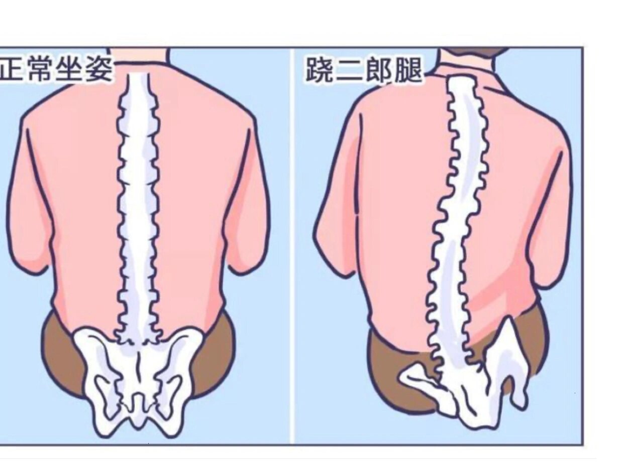 跷二郎腿骨盆图片