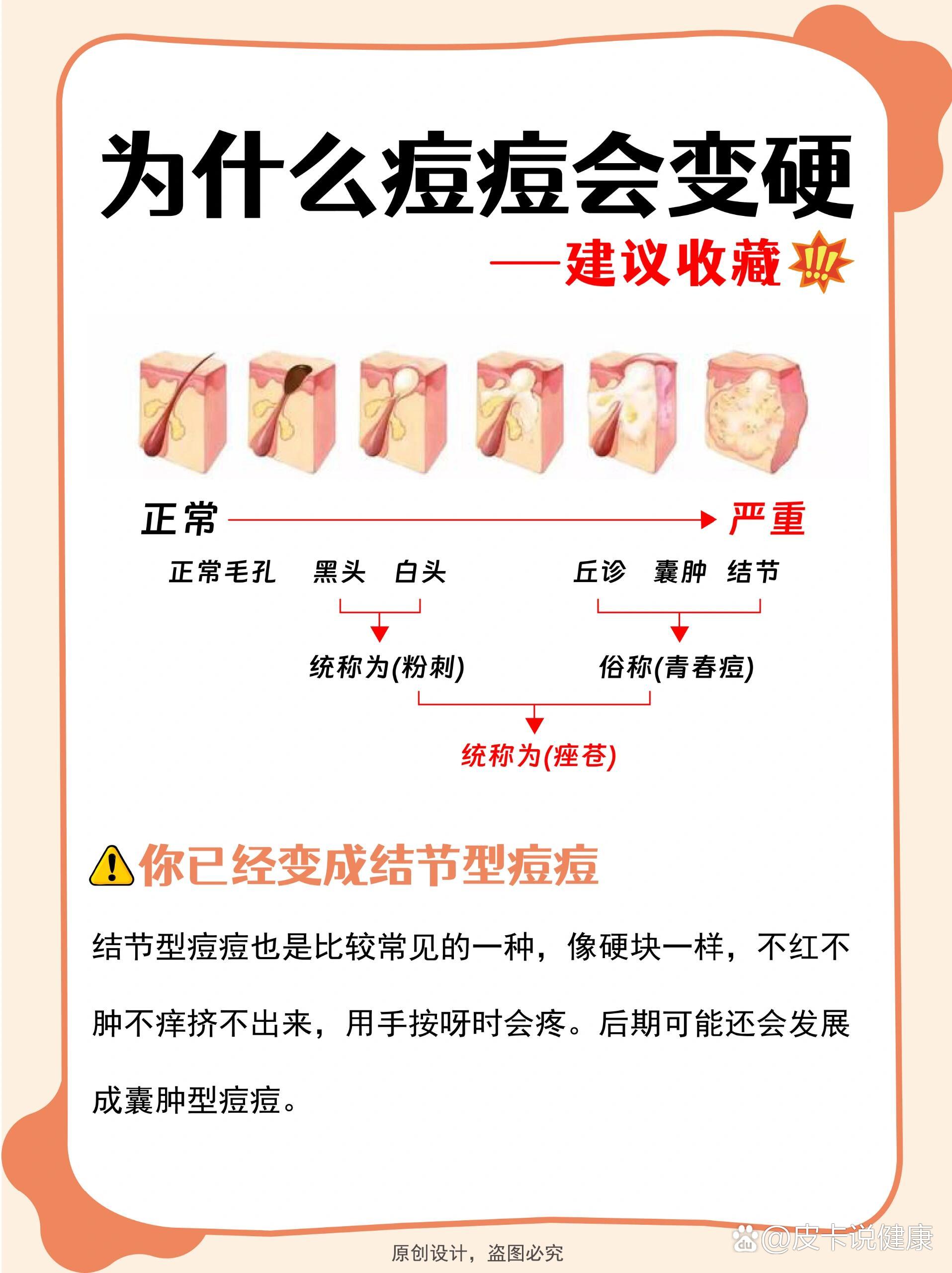 脸上长痘为什么