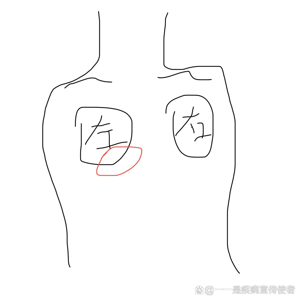 左胸下方痛是什么原因