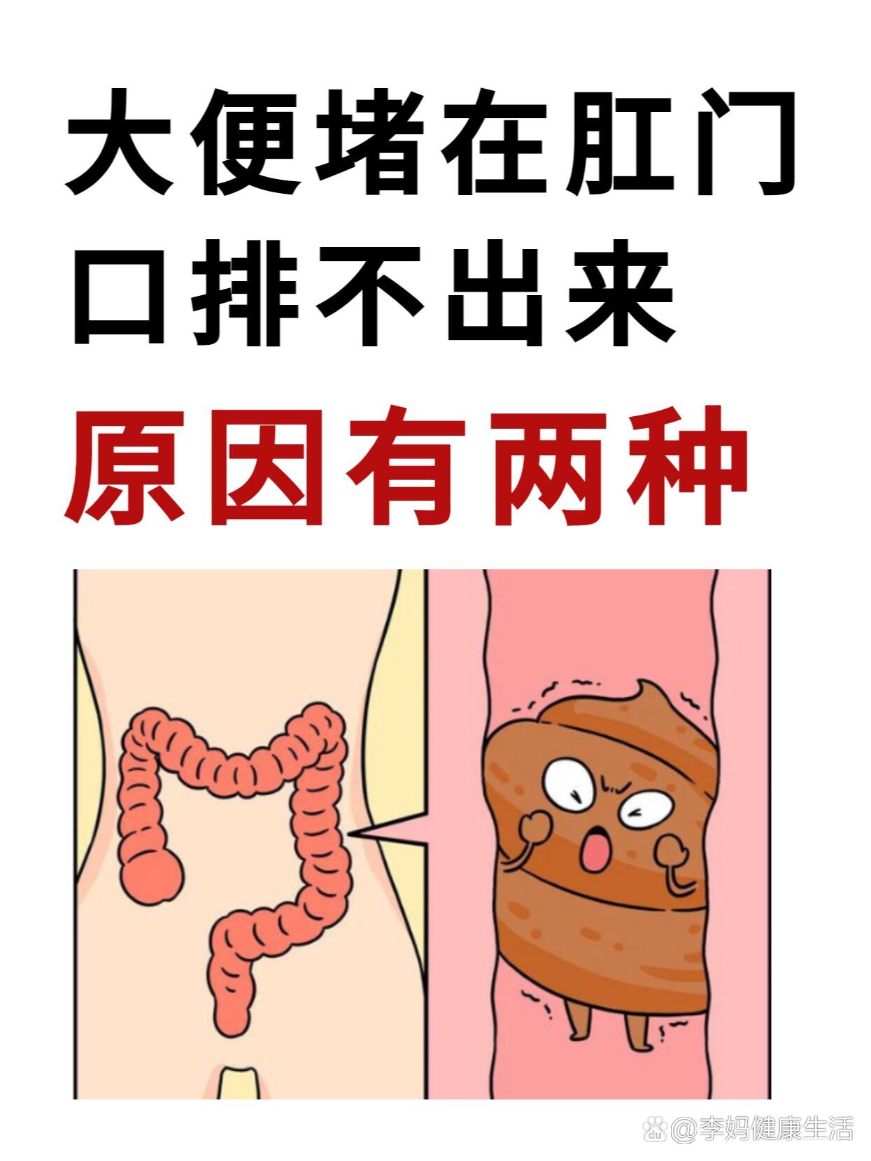 大便堵在肛门口是什么原因