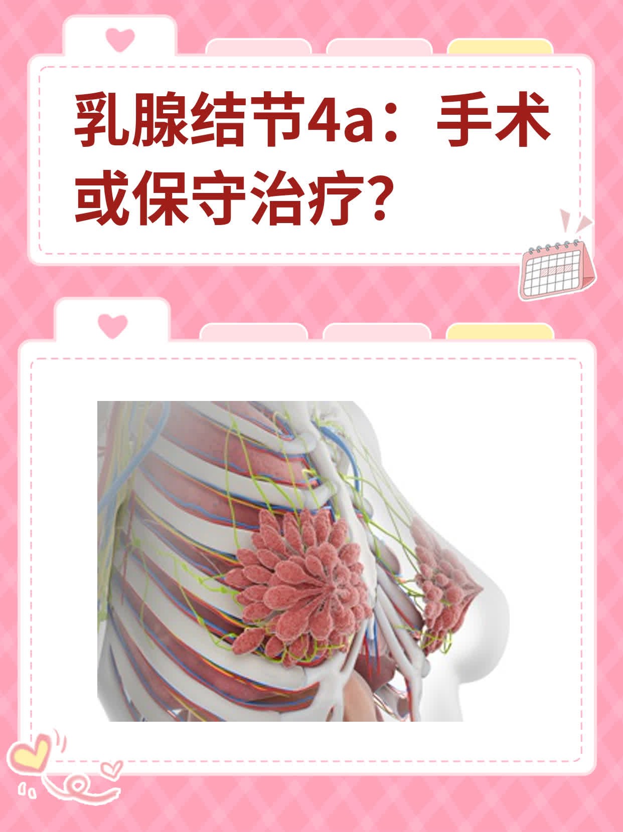 乳腺结节能摸出来吗图片