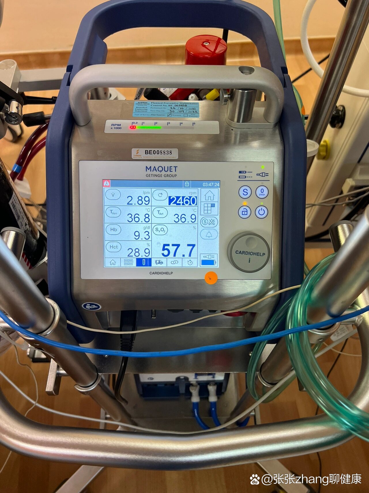 当体外膜肺氧合(ecmo)与主动脉球囊反搏术
