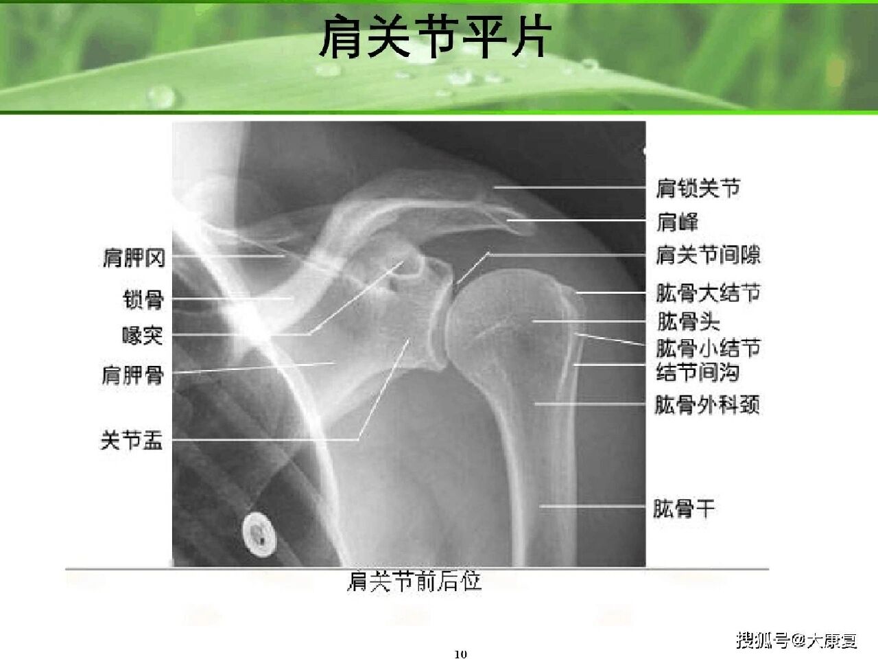 头颈肩骨骼图片