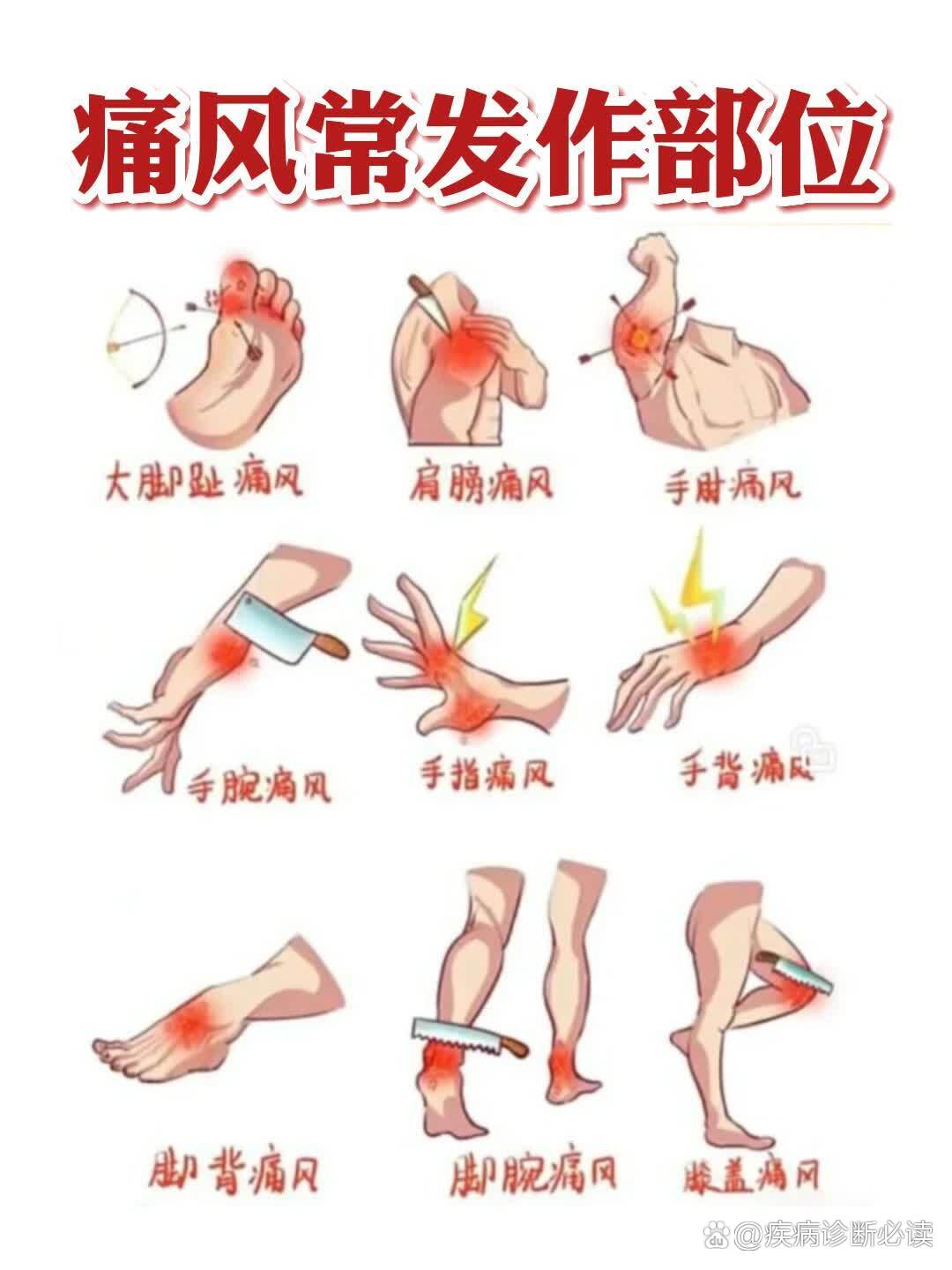 手指 手臂脚背脚腕 膝盖