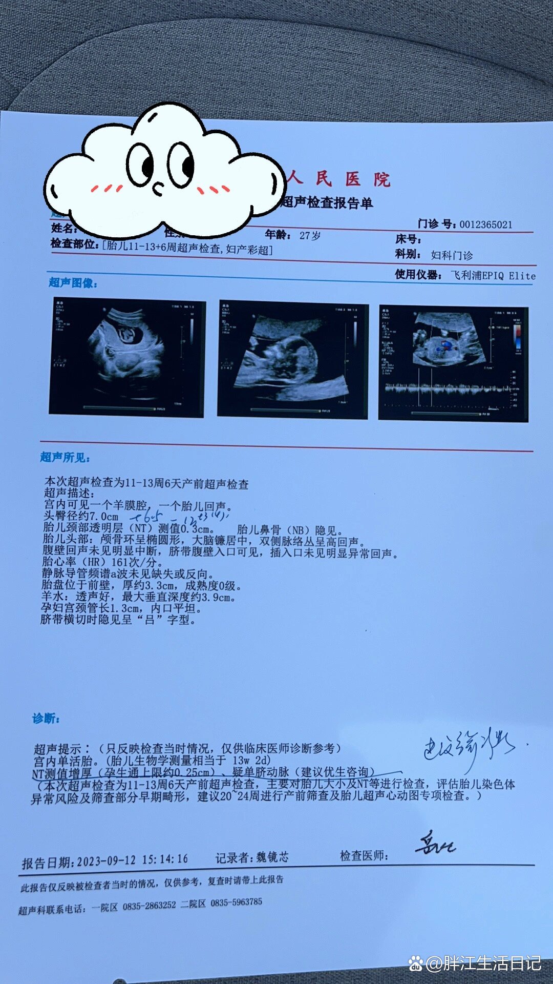 nt增厚3.0合并单脐动脉,宝宝能留吗?
