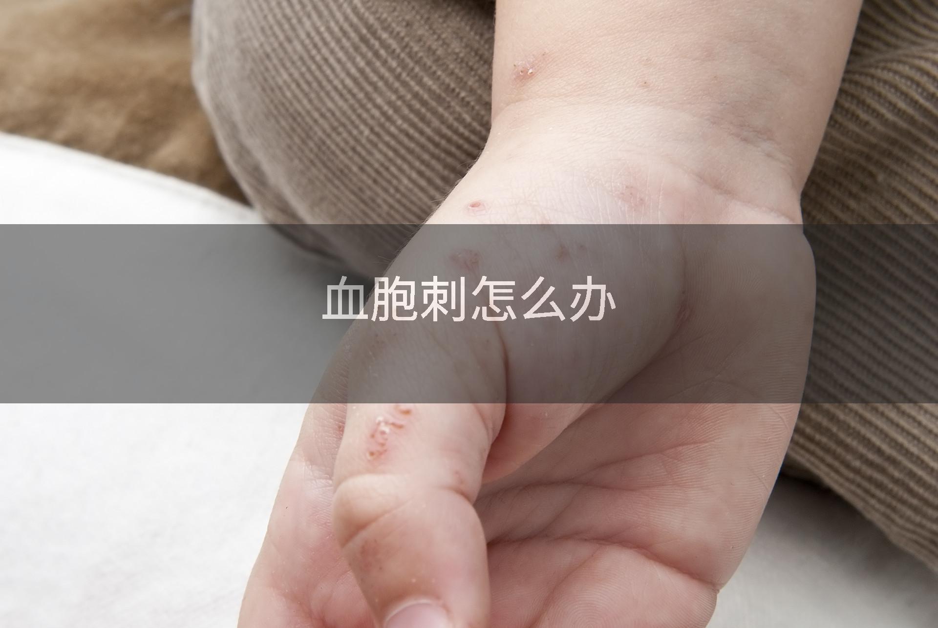 血胞刺怎么办