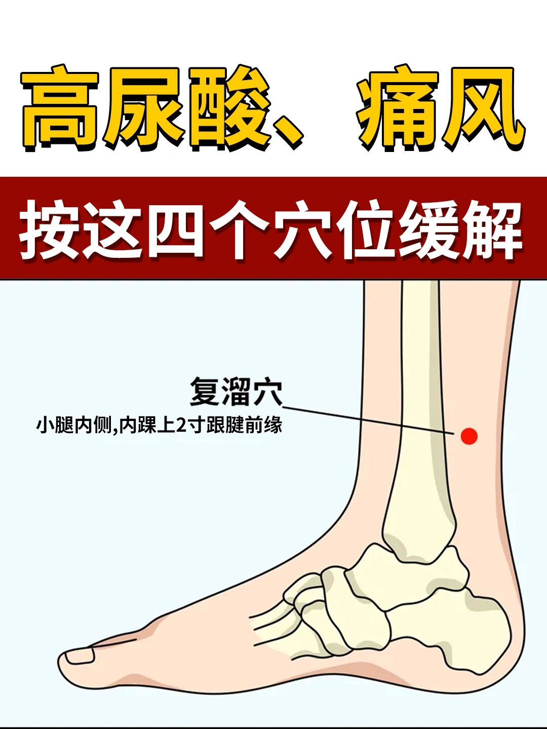 高尿酸,痛风患者这几个穴位你一定要知道
