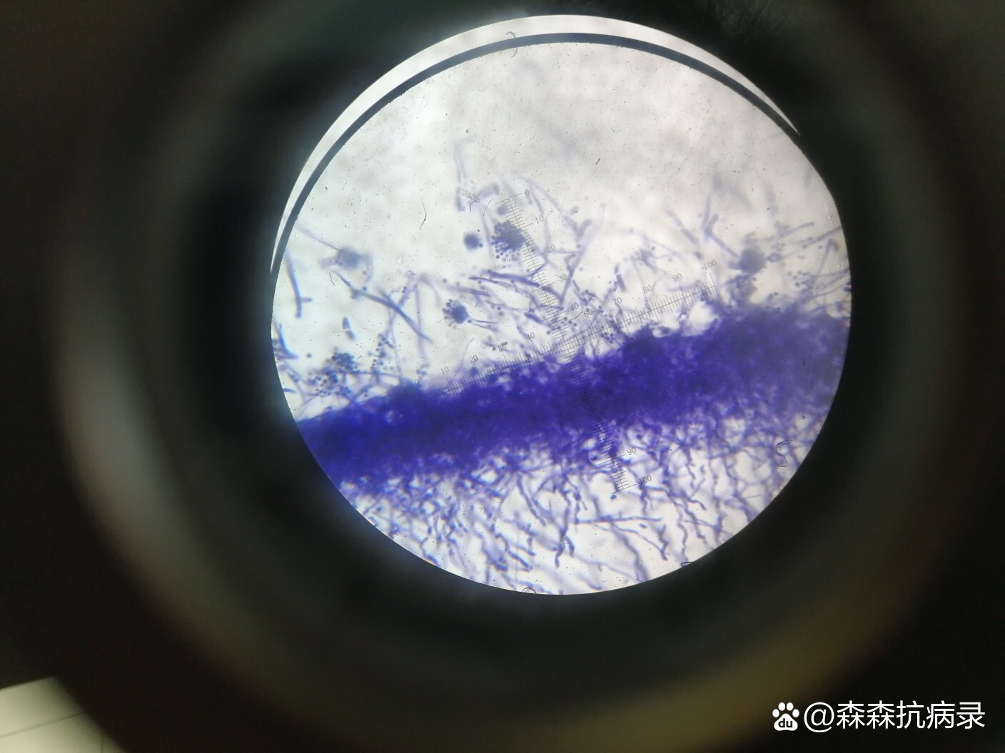 显微镜94下的真菌9699