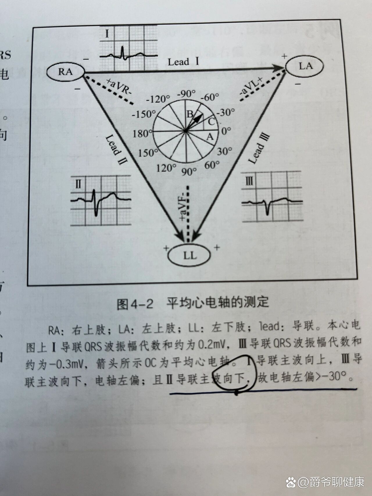 每日学习心电图～～电轴