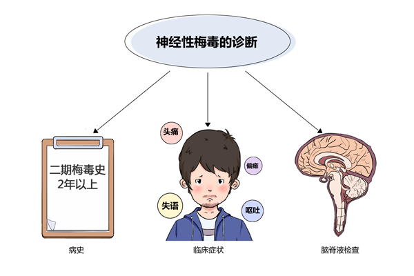 如何判断神经梅毒