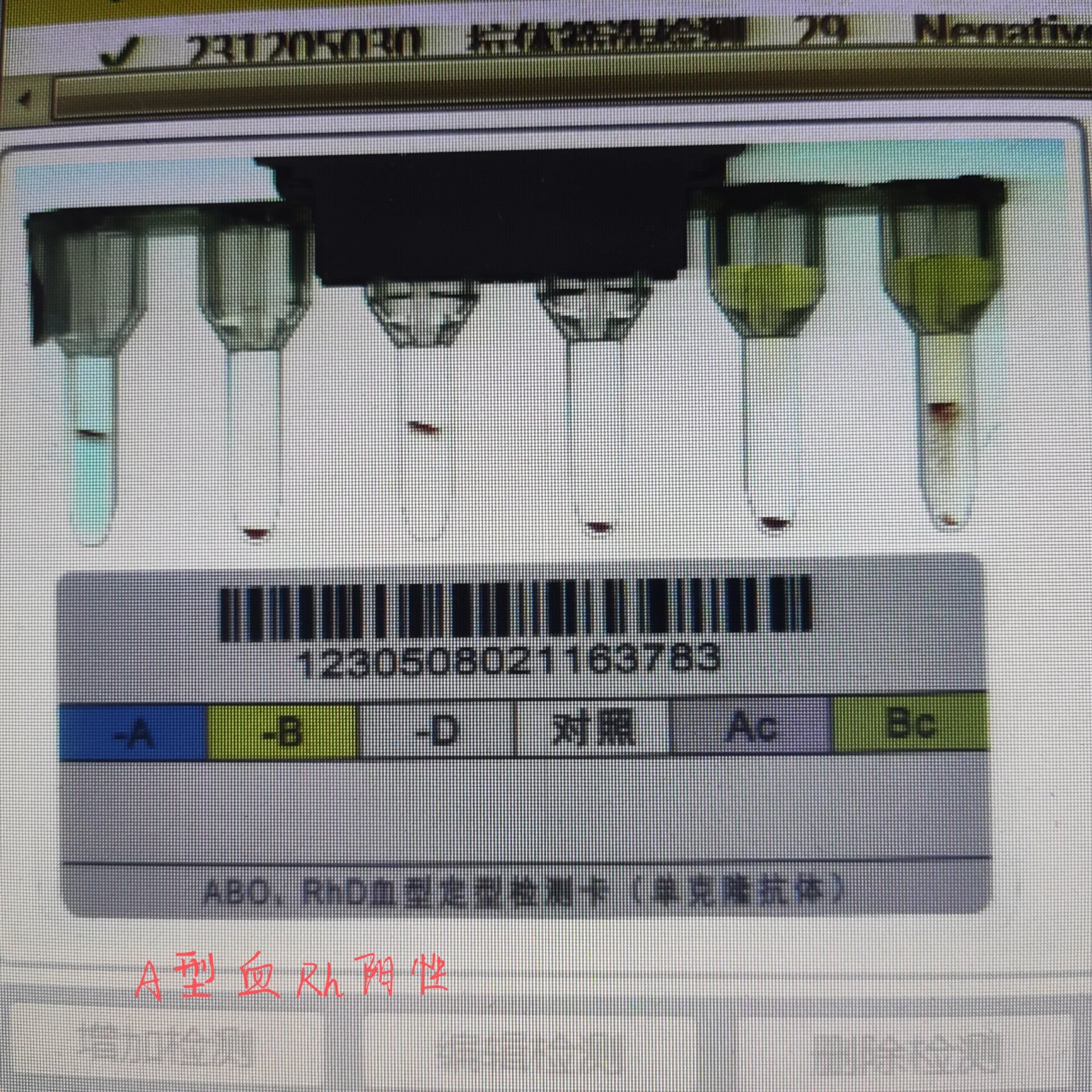 B型阴性血图片