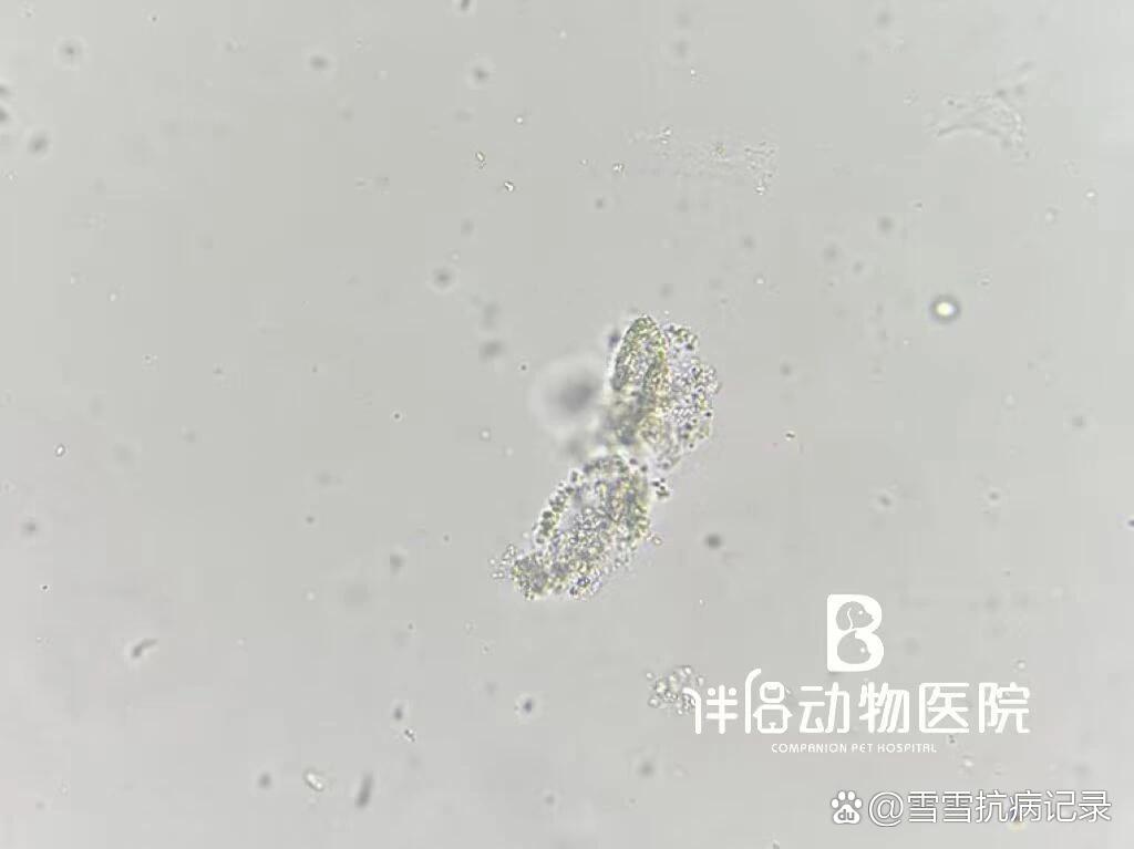 【显微镜下小世界-颗粒管型】颗粒管型是含有颗粒的透明管型