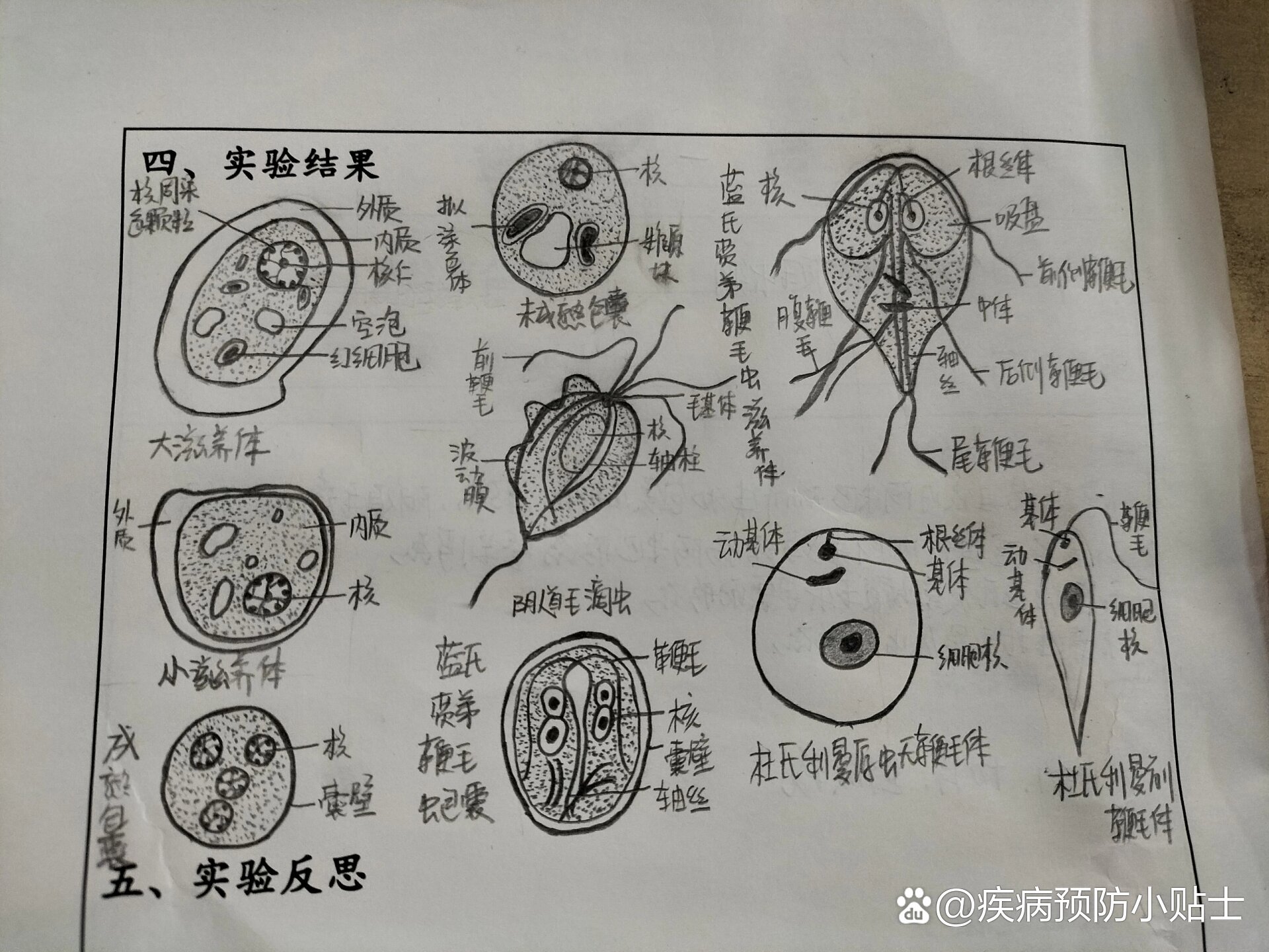 人体寄生虫学手绘图