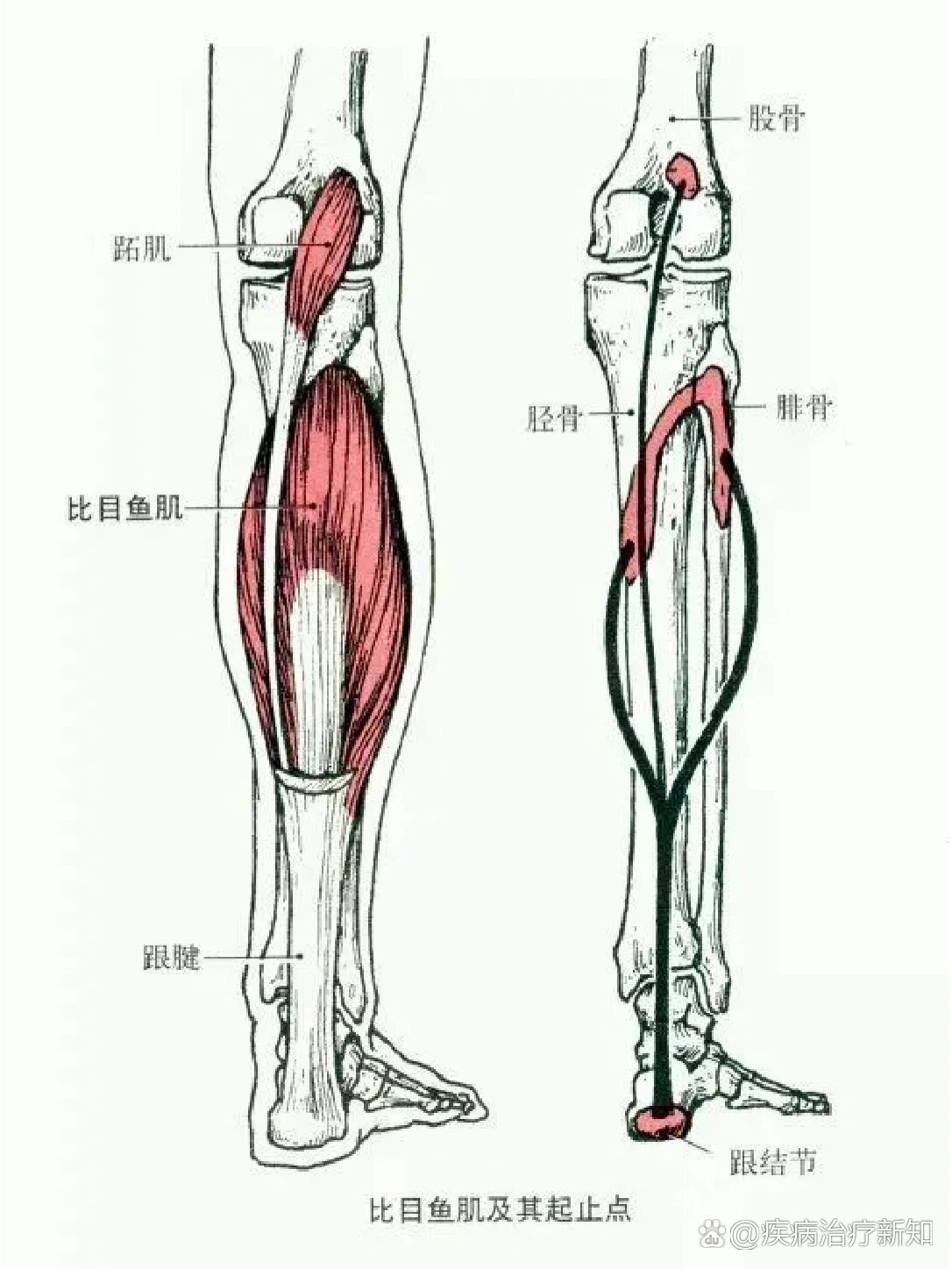 小腿肌腱解剖图片